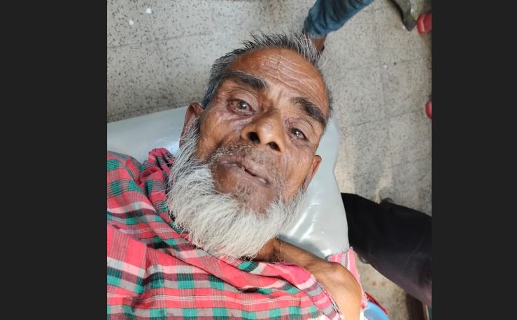 যশোরে বোমা সদৃশ্য বস্তু বিস্ফোরণে বৃদ্ধ আহত