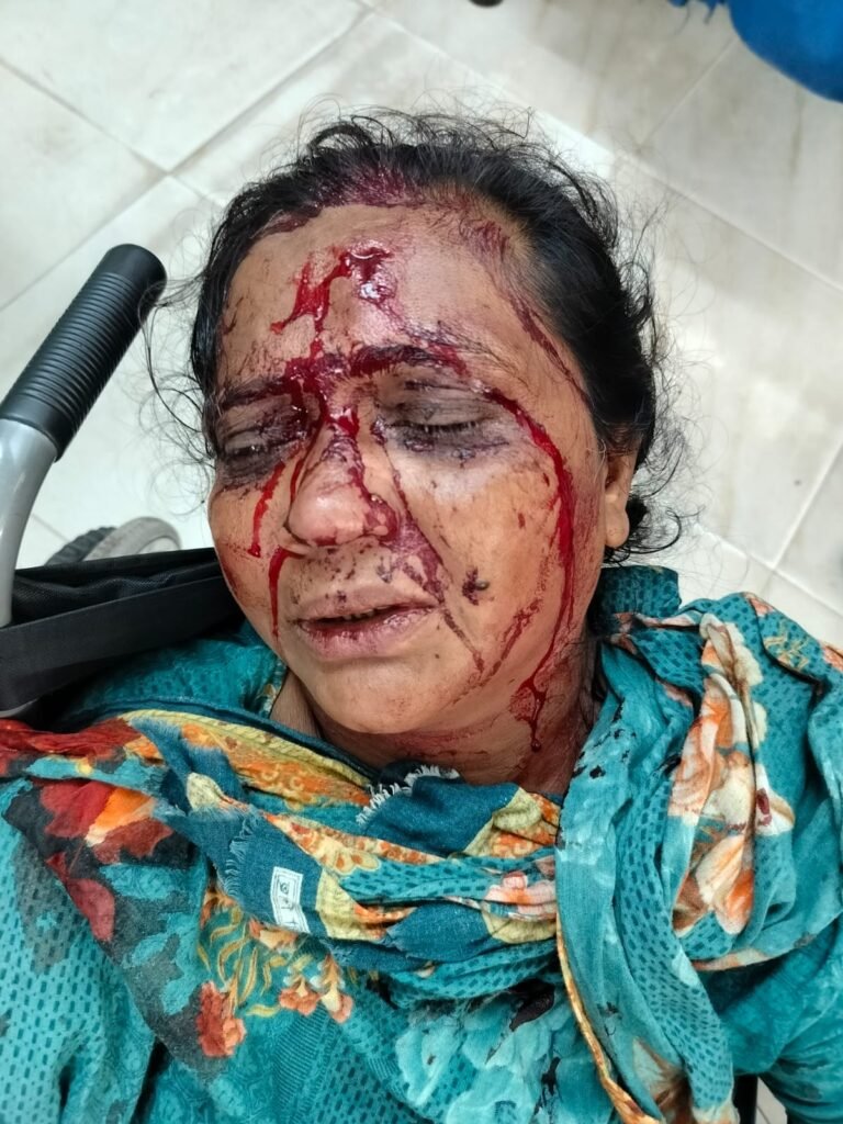 যশোরে ইট দিয়ে মেরে নারীর মাথা থেঁতলে দিলো যুগল