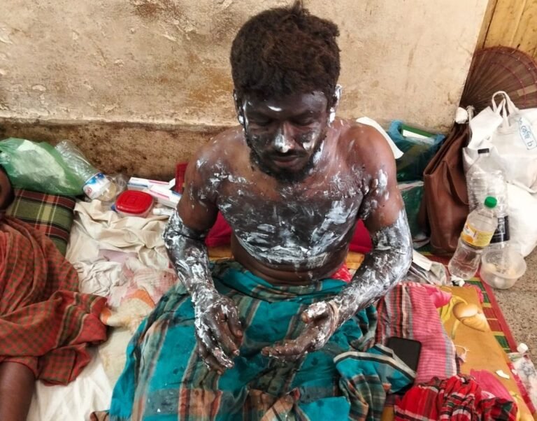 যশোরে পৃথক ঘটনায় তিনজন দগ্ধ