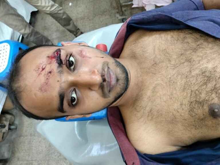 যশোরে পৃথক ঘটনায় আহত ৪