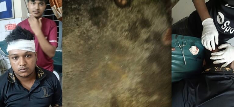 যশোরের শার্শায় ককটেল বিস্ফোরণ, আহত ১