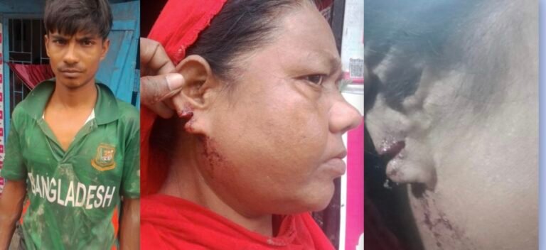 যশোরে প্রতিবেশীর হামলায় মা-ছেলে আহত, কান ছিড়ে স্বর্ণালংকার লুটের অভিযোগ