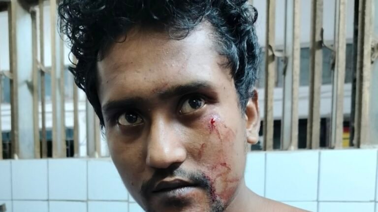 যশোরে ক্রিচের আঘাতে যুবক আহত