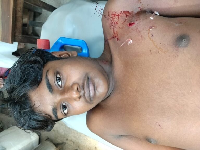 মনিরামপুরে পারিশ্রমিকের টাকা ভাগাভাগি নিয়ে কিশোর দিনমজুরকে কাঁচি দিয়ে আহত