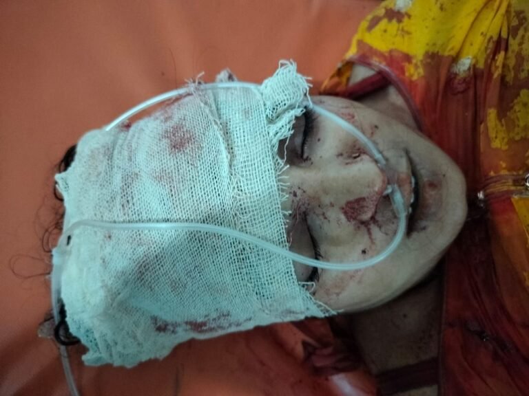 মনিরামপুরে সড়ক দুর্ঘটনায় নারীর মৃত্যু