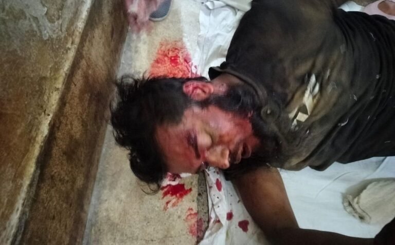 ডিজেলের সিলিন্ডার বিস্ফোরণে যশোরে ওয়ার্কশপ শ্রমিক গুরুতর আহত