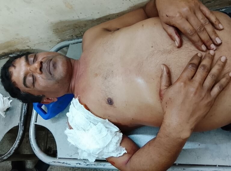 যশোরে চাচাতো ভাইয়ের ছুরিকাঘাতে জখম এক ব্যক্তি