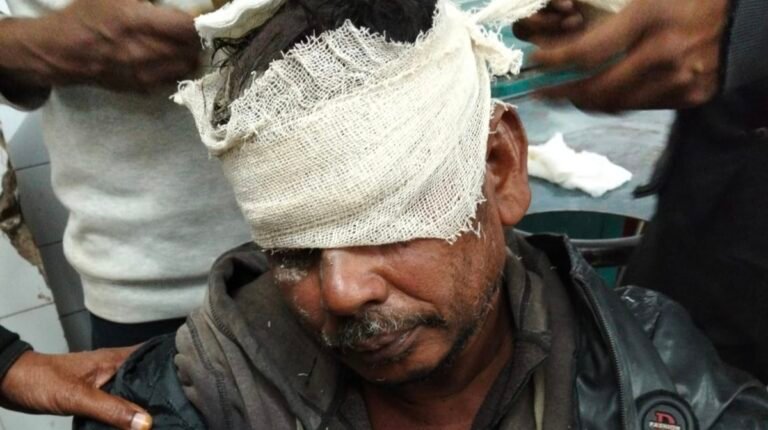 যশোরে পৃথক দুই ঘটনায় হামলায় অটোরিকশা চালকসহ দুই ব্যক্তি আহত