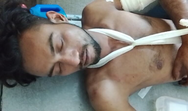 যশোরে পিতার কোপে ছেলে আহত