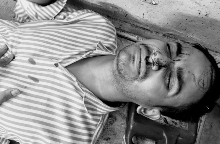 যশোরে তরুণীর সাথে দেখা করতে এসে মাইরপিটে যুবক আহত, হাসপাতালে ভর্তি