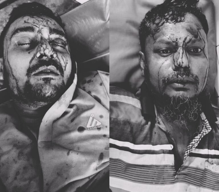 যশোরে পারিবারিক কলহে দুইজনকে পিটিয়ে আহত, হাসপাতালে ভর্তি