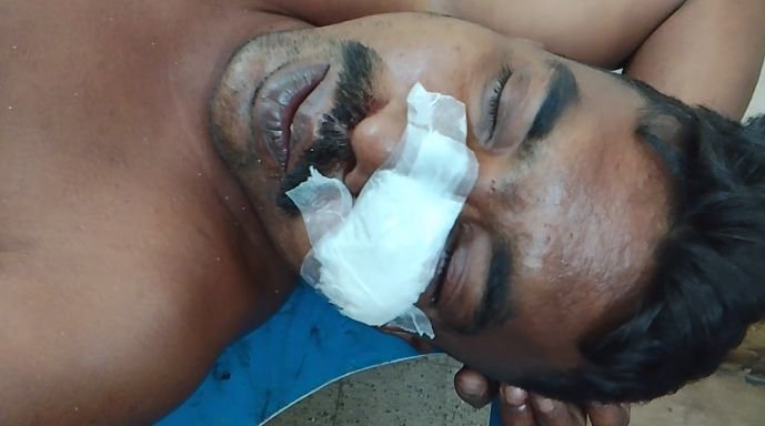 পূর্ব শত্রুতার জেরে বেনাপোলে এক ব্যক্তিকে কুপিয়ে জখম