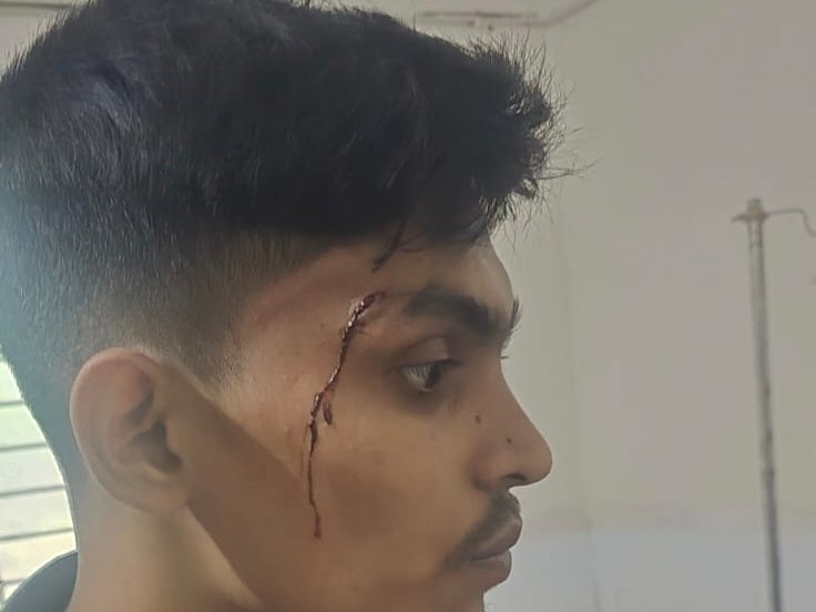 বেনাপোলে লাগেজ ব্যবসায়ীদের সংঘর্ষ, ছুরিকাঘাতে আহত ৩