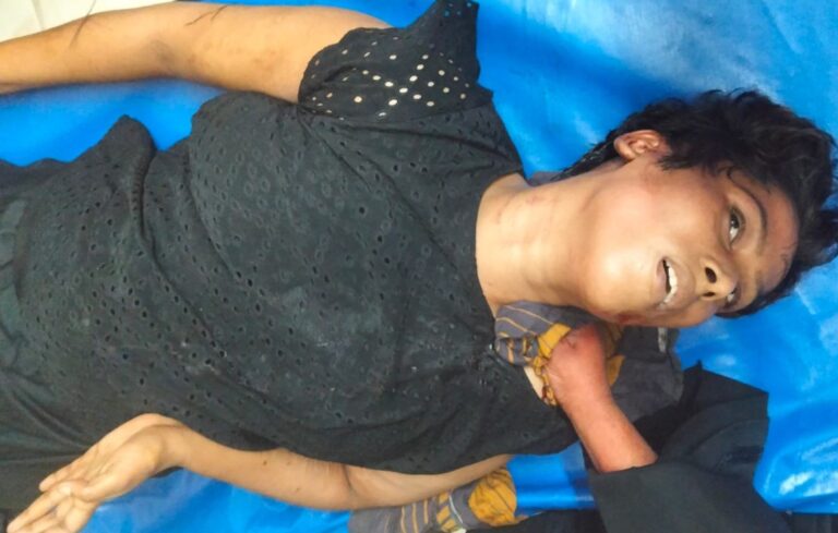 যশোরে পারিবারিক কলহে বোনের ছুরিকাঘাতে নারী আহত