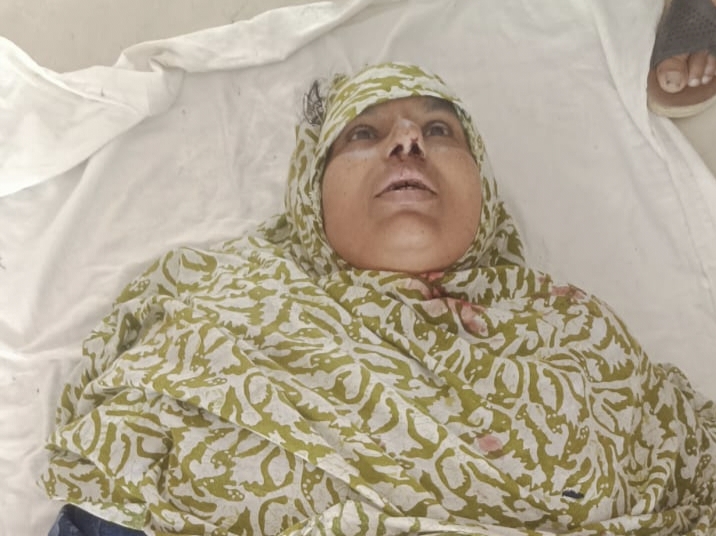 যশোরে পৃথক সড়ক দুর্ঘটনায় নিহত ১, আহত ৫
