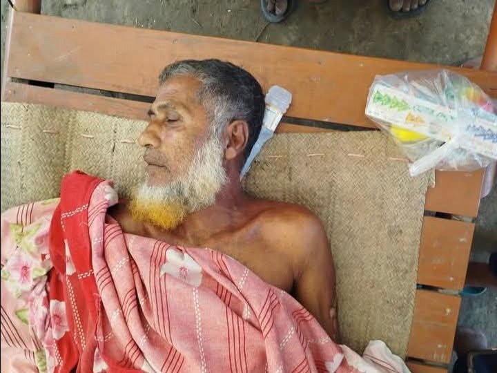 যশোর শার্শায় বিদ্যুৎস্পৃষ্ট হয়ে কৃষকের মৃত্যু