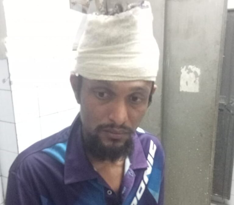 যশোরে পারিবারিক বি/রো/ধে ছোট ভাইয়ের হা/ম/লা/য় /আ/হ/ত যুবক হাসপাতালে