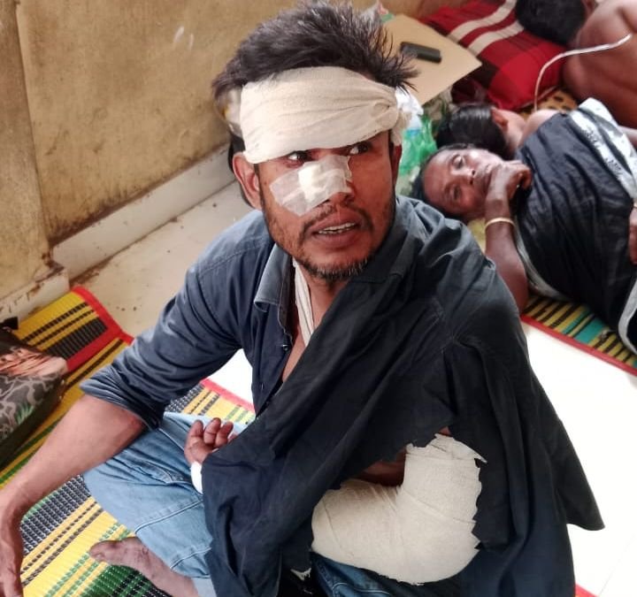 বেনাপোলে পারিবারিক বিরোধে ছোট ভাইয়ের দায়ের কো/পে বড় ভাই গুরুতর