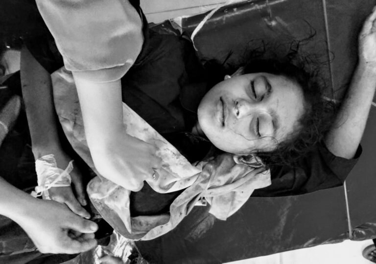যশোর-চৌগাছা সড়কে বেপরোয়া মোটরসাইকেলের ধাক্কায় ৫ শিক্ষার্থীসহ উভায় পক্ষের আহত